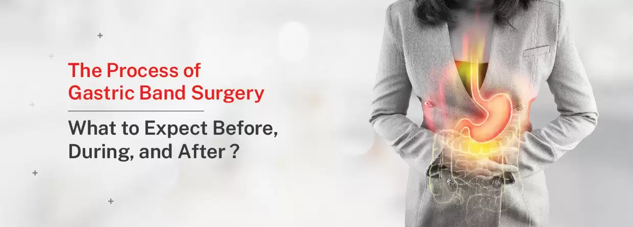 The Process of Gastric Band Surgery: What to Expect Before, During, and After